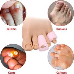Hyggear™ Hammer Toe Fix - Hammer Toes Sleeve with Overlap Medium Size Roll, Sponge Toe Protectors for Hammer Toes - 23329353031