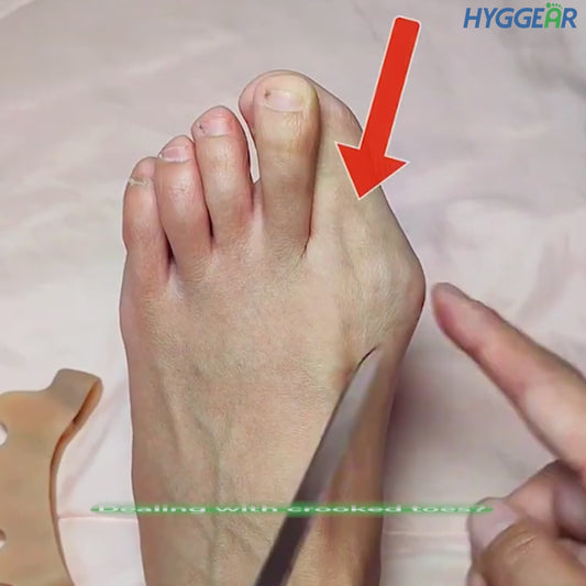 Special Bundle Offer - Hyggear Double Toe Separator